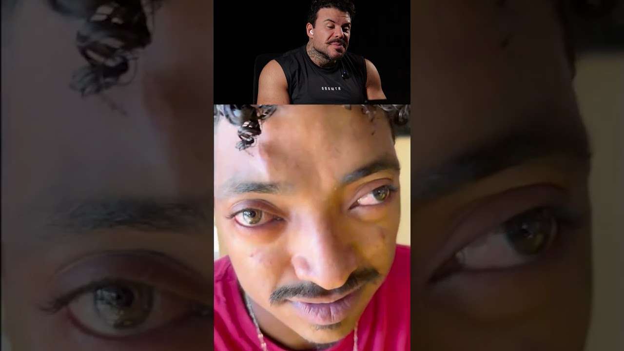 Ele Errou O Alvo Com Sucesso