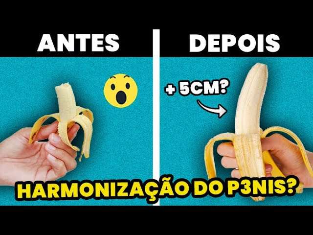 HARMONIZAÇÃO P3NIANA? Médico Especialista Explica TUDO sobre o Procedimento | GLOW UP MASCULINO