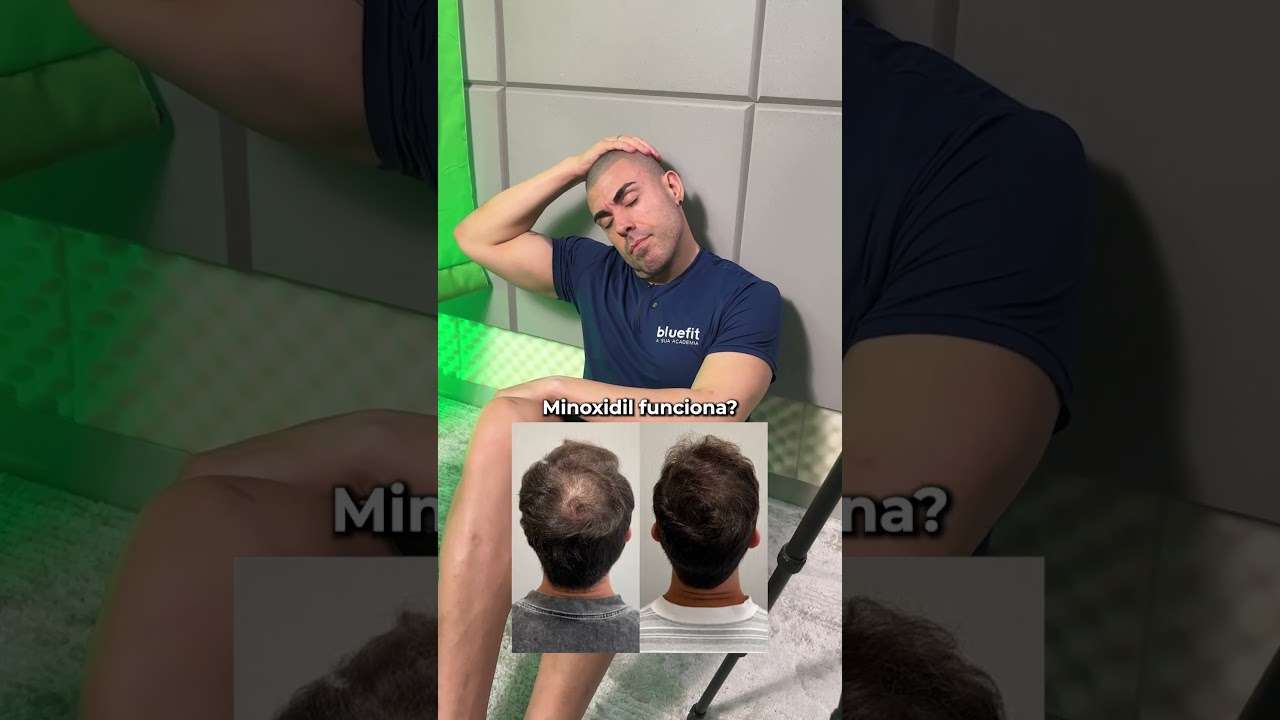 Principais duvidas - Minoxidil #shorts
