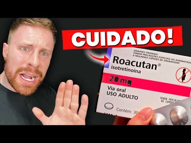ROACUTAN: Funciona? Quais os Efeitos Colaterais? DERMATOLOGISTA conta TUDO sobre o Tratamento