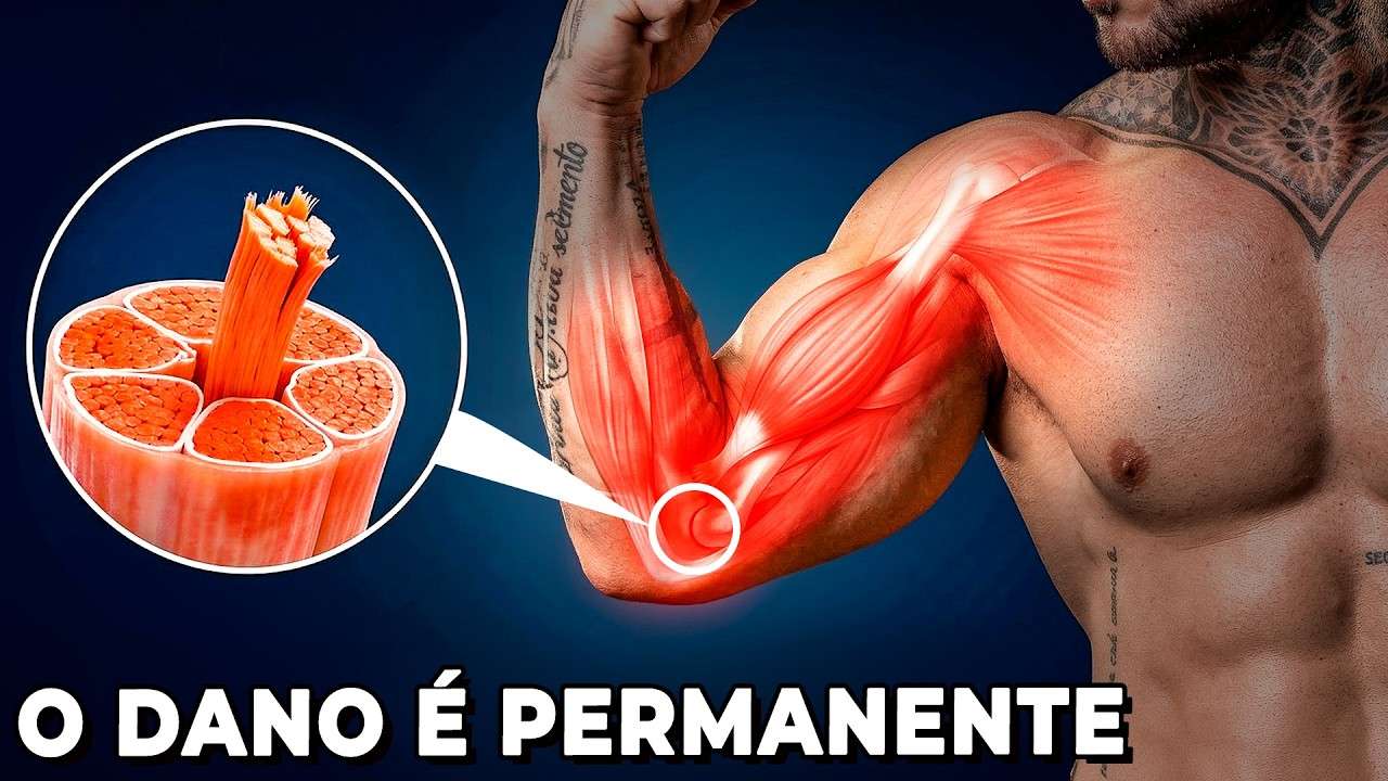 Por que Seus Tendões Nunca se Curam