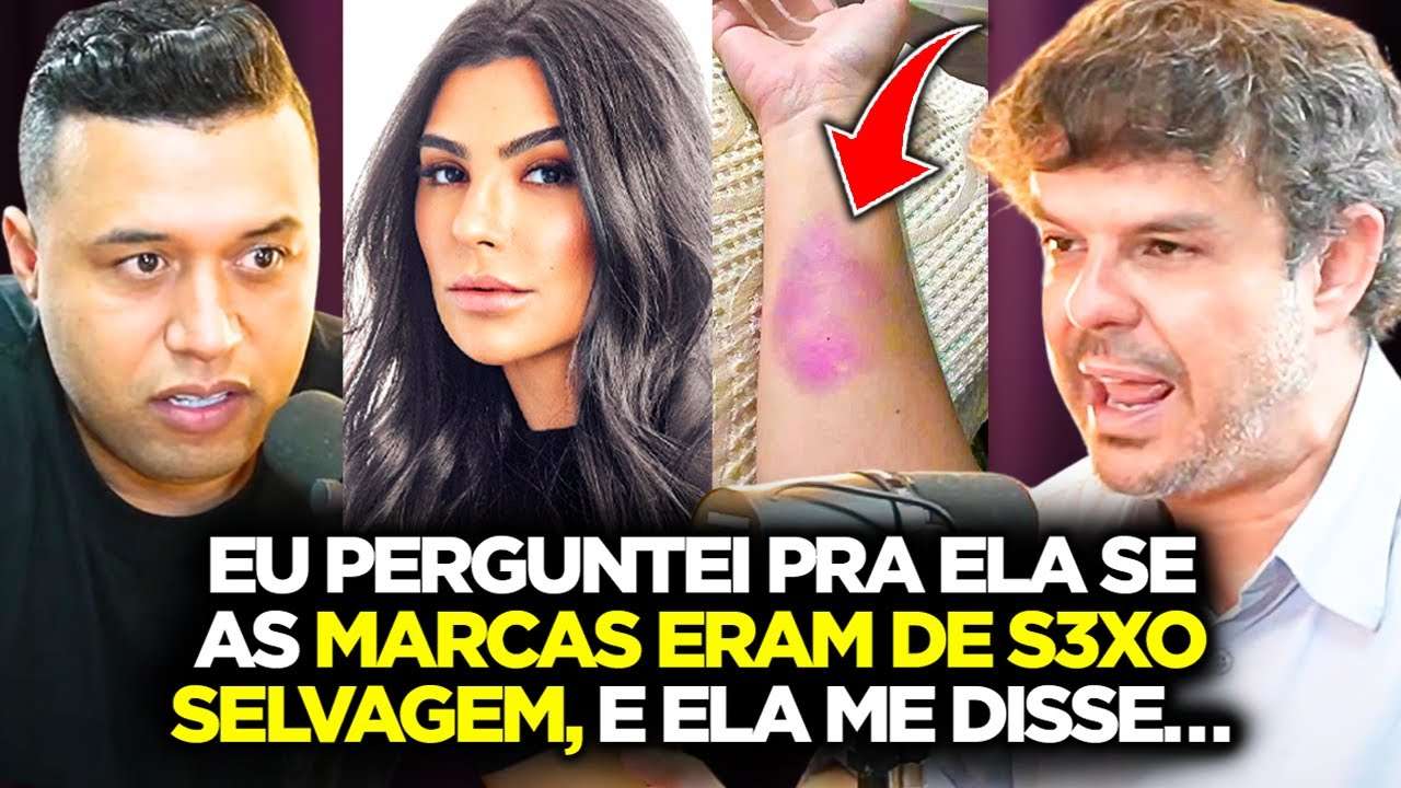 ADRILLES ABRE O JOGO SOBRE AS MARCAS DE AGRESS*O DE CINTIA CHAGAS