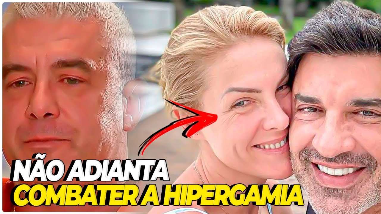 Ana Hickmann e Edu Guedes: Relacionamento é um Jogo Feito pra Você Perder