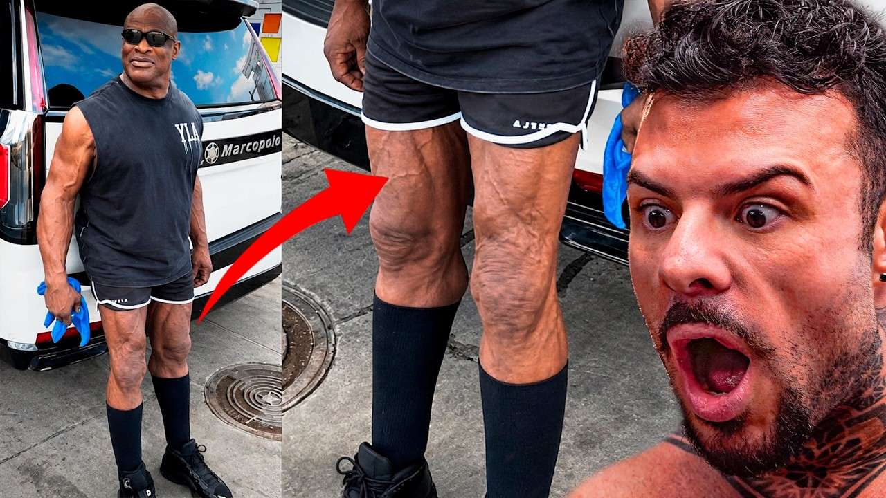 Que Aconteceu com as Pernas do Coleman!