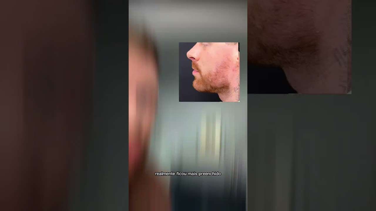 Vocês fariam esse tipo de HARMONIZAÇÃO FACIAL? 😎🔥 #harmonizacaofacial #estilomasculino