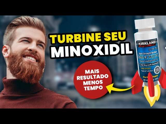 Como TURBINAR o MINOXIDIL? 4 Coisas para Aumentar os Efeitos do Tratamento