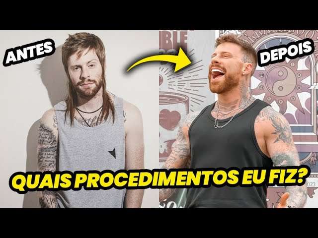 4 PROCEDIMENTOS ESTÉTICOS que Fiz, pra ficar mais BONITO, que NÃO me ARREPENDO