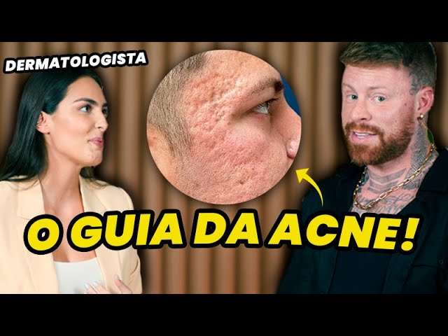 TUDO SOBRE ACNE: Dermatologista responde as PRINCIPAIS Dúvidas sobre ESPINHAS, CRAVOS e CICATRIZES