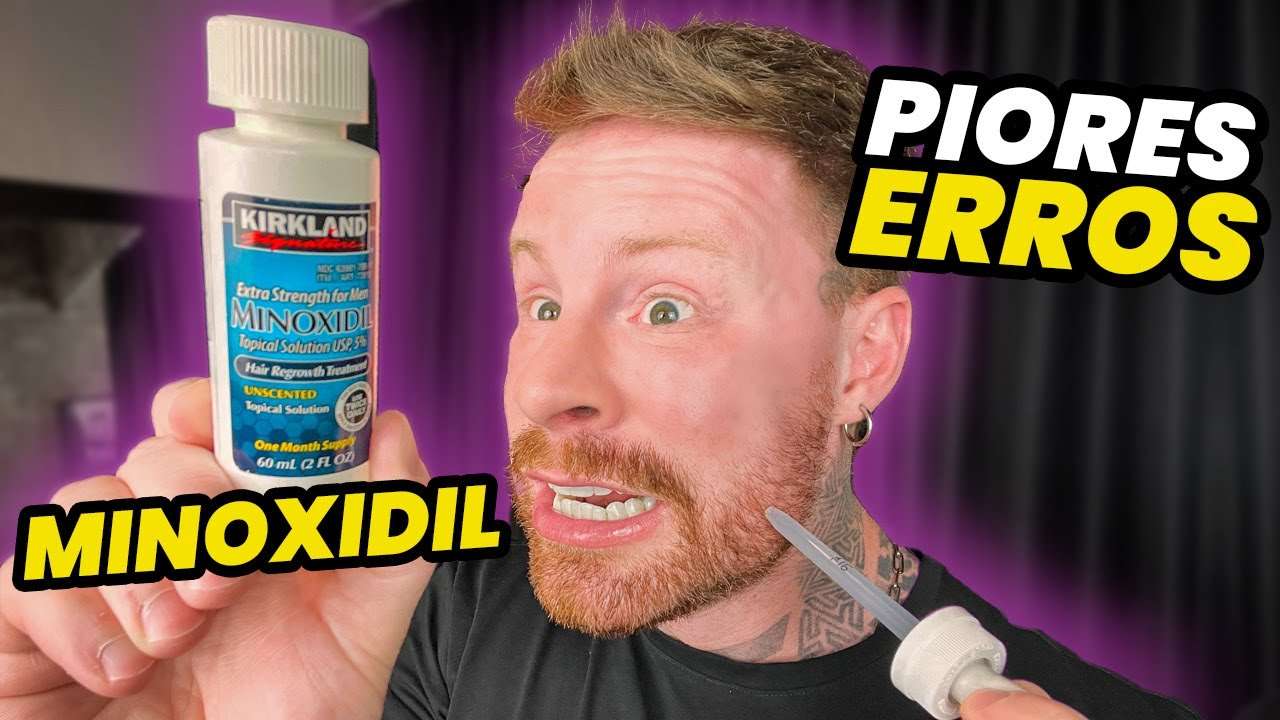 MINOXIDIL: 4 ERROS ao usar que DESTROEM o EFEITO do TRATAMENTO (Parte 04)