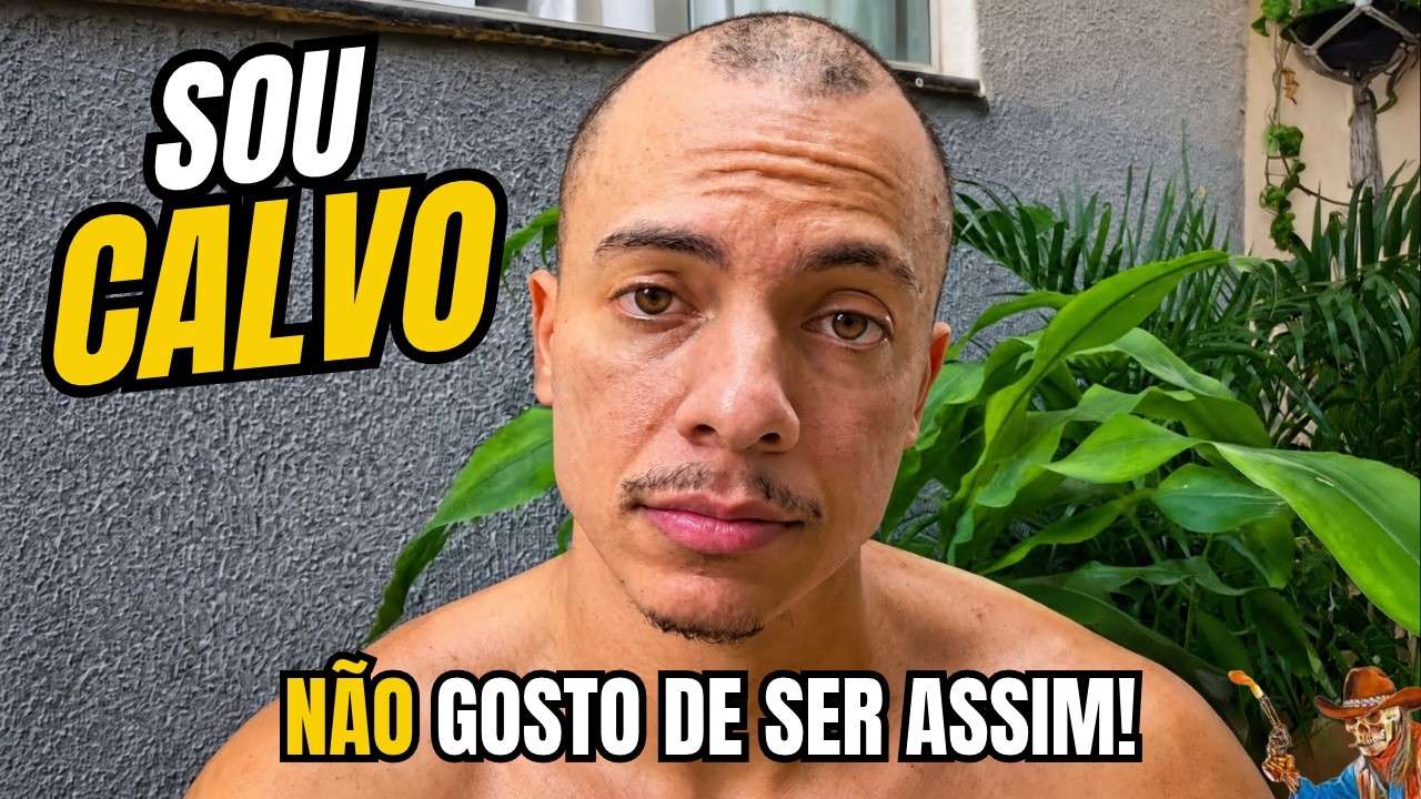 SOU CALVO E NÃO AGUENTO MAIS ISSO!!