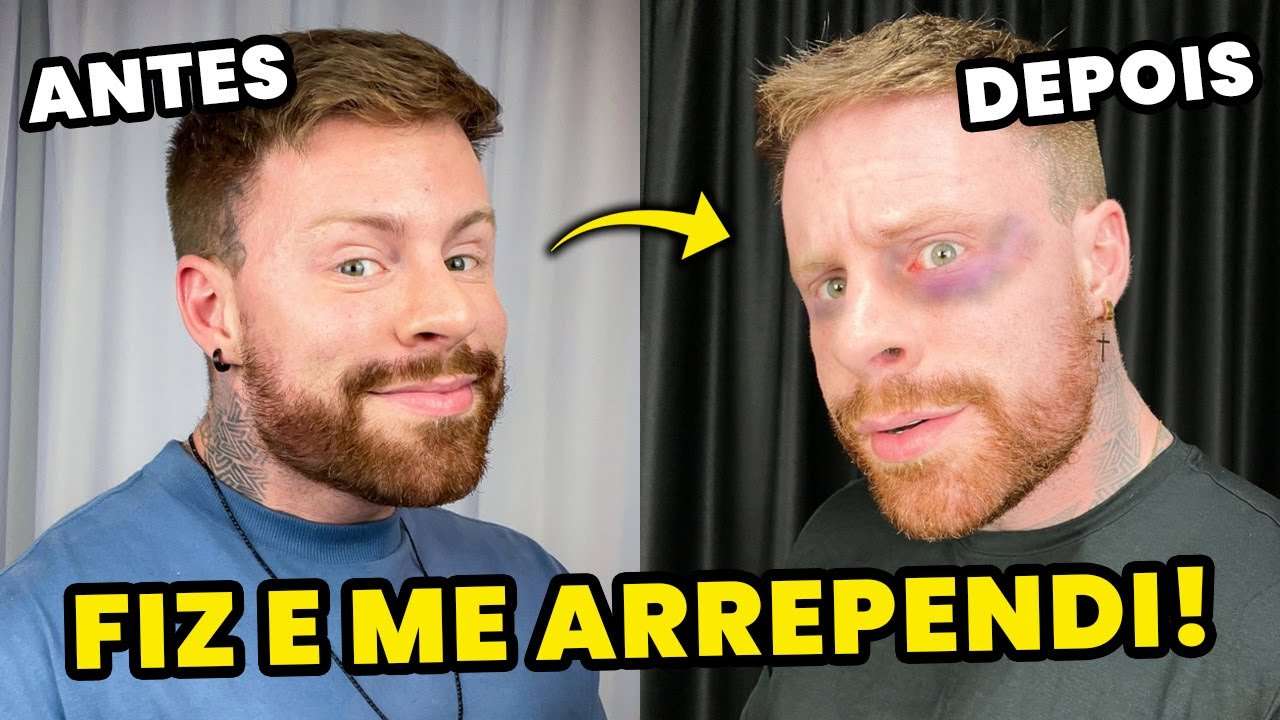 3 PROCEDIMENTOS ESTÉTICOS que Fiz e me ARREPENDI